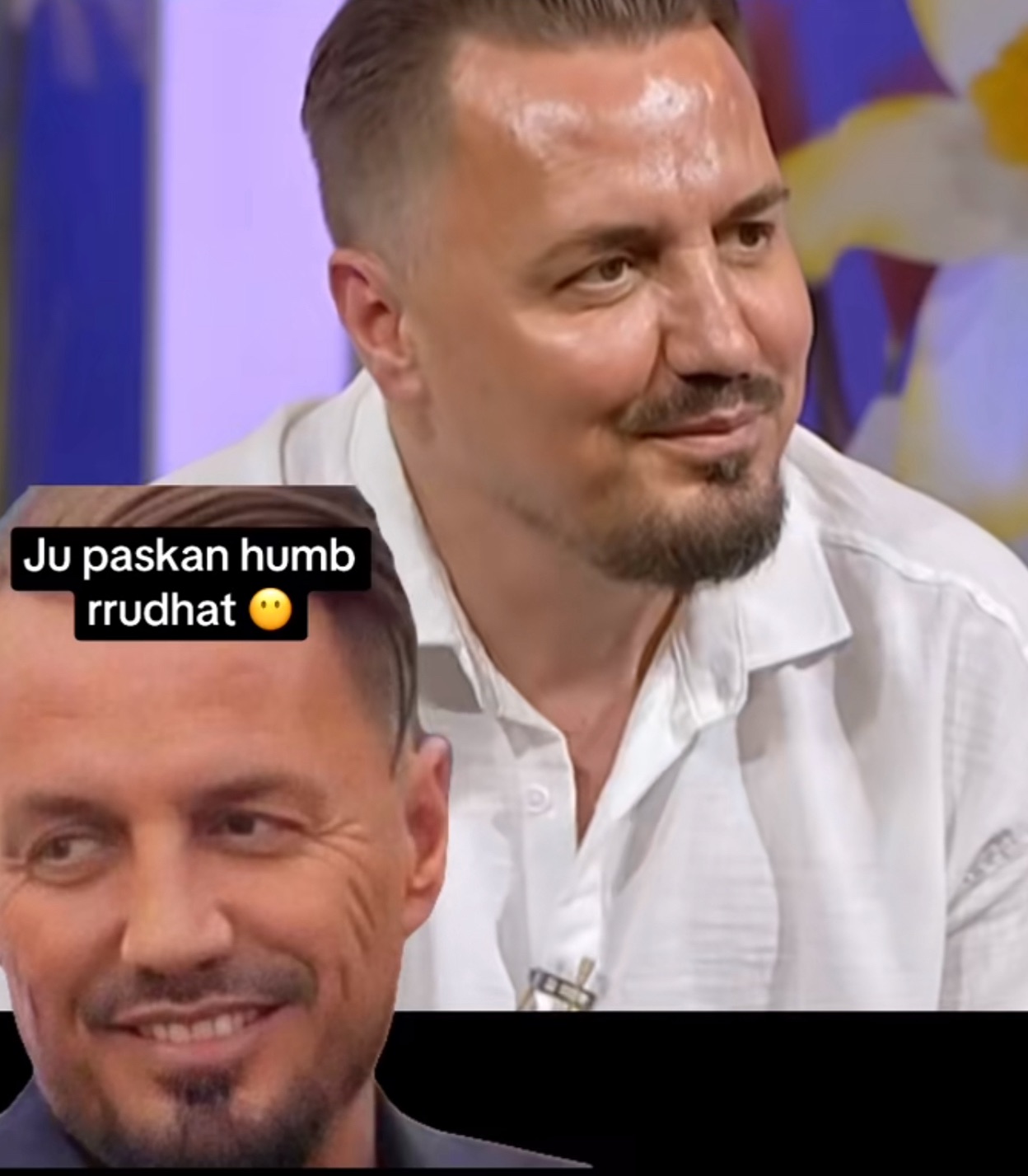 💉 Blero i ri – pa rrudha, pa mimika? Rrjeti “çmendet” pas fytyrës së re të këngëtarit: “E pashë dy herë me u siguru a është ai!” 😳