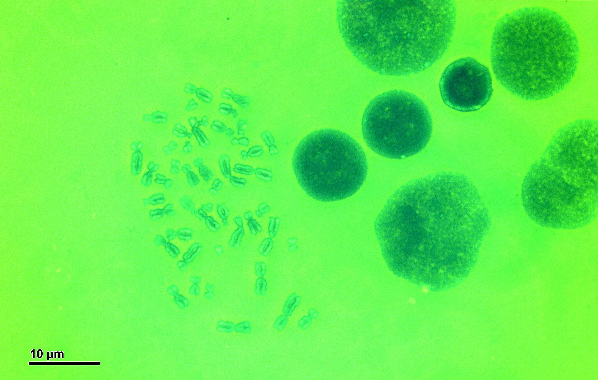 Human chromosomes seen under a microscope