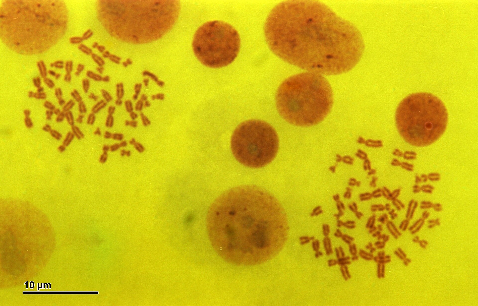 Human chromosomes stained and magnified